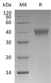 Recombinant Mouse CD38 (C-6His)