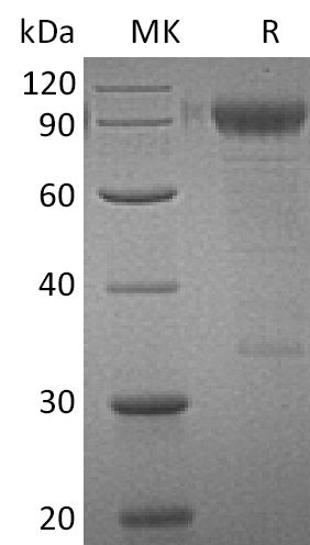 Recombinant Human IL-3RA (C-Fc)
