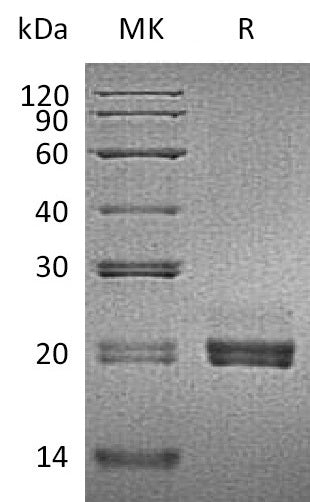 Recombinant Mouse CD40L (N-6His)