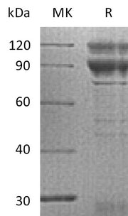 Recombinant Human Coagulation Factor X (C-Fc)