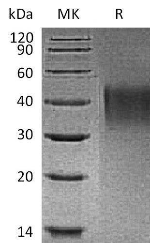 Recombinant Mouse TIM-1 (C-6His)