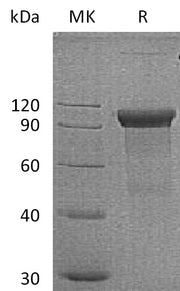 Recombinant Human ROR1 (C-Fc)