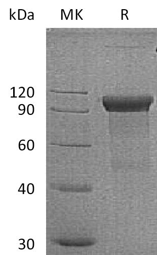 Recombinant Human ROR1 (C-Fc)