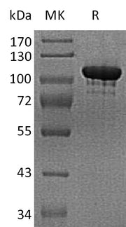 Recombinant Human ENPP-2 (C-6His)
