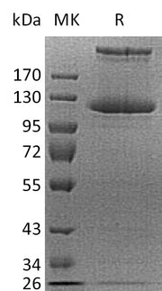 Recombinant Human COL21A1 (C-6His)