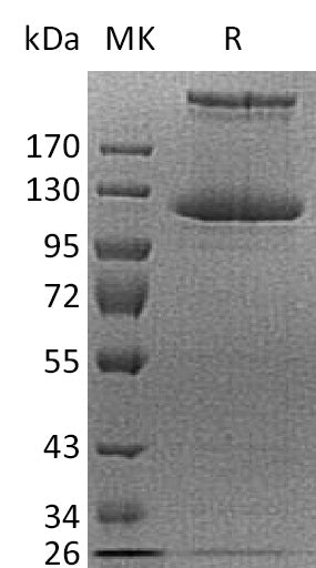 Recombinant Human COL21A1 (C-6His)