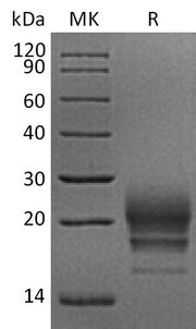 Recombinant Rhesus Macaque CD160 (C-6His)