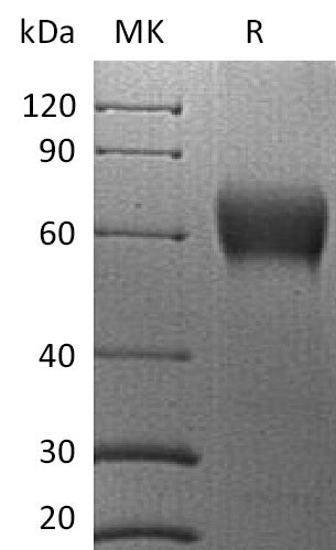 Recombinant Human VISTA (C-mFc)