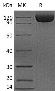Recombinant Human CD26 (C-6His)