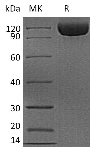 Recombinant Human CD26 (C-6His)