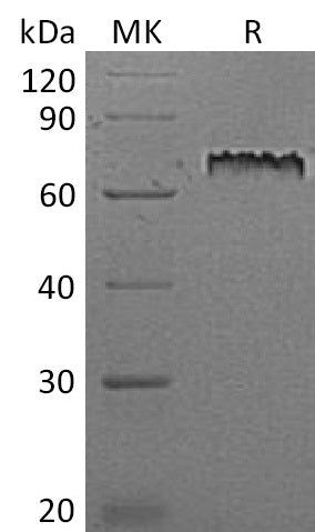 Recombinant Mouse Notch 1 (C-6His)