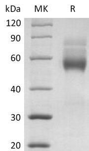 Recombinant Human HVEM (C-mFc)