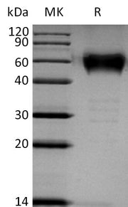 Recombinant Human BTLA (C-mFc)