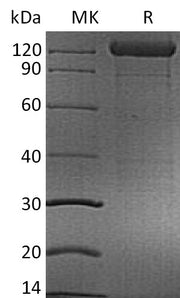 Recombinant Human CD96 (C-mFc)