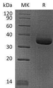 Recombinant Human ANGPTL4 (N-6His)