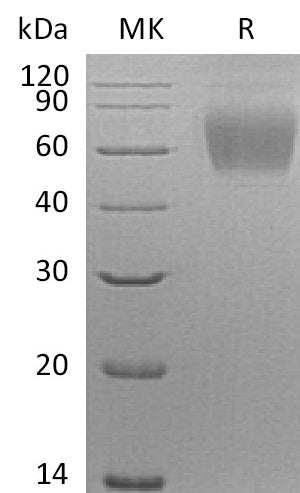 Recombinant Human Siglec-9 (C-6His)