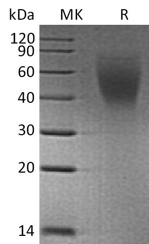 Recombinant Human CA125 (C-6His)
