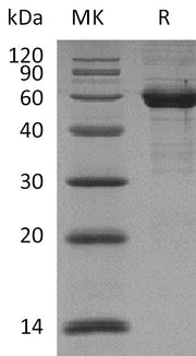 Recombinant Human Siglec-15 (C-mFc)