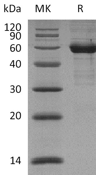 Recombinant Human Siglec-15 (C-mFc)