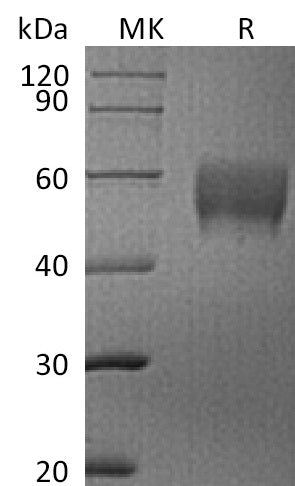 Recombinant Human Siglec-7 (C-6His)