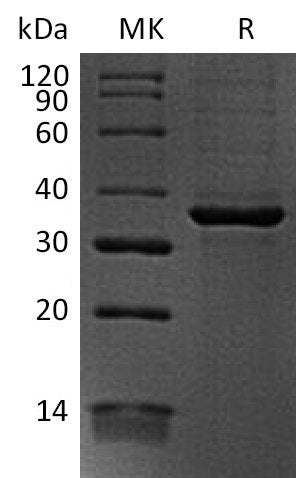 Recombinant Human FGL1 (C-6His)