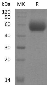 Recombinant Mouse IL-1RL2 (C-6His)