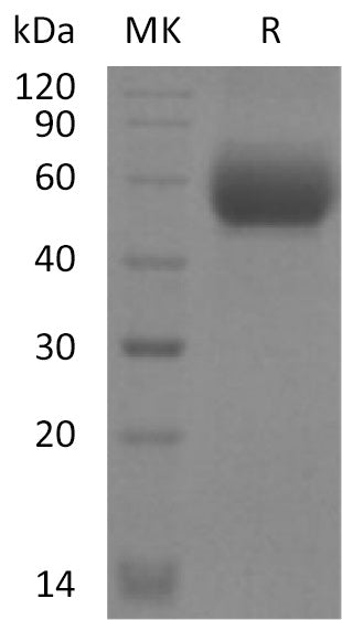Recombinant Mouse IL-1RL2 (C-6His)