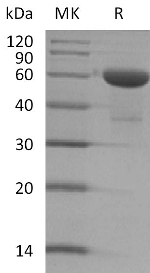 Recombinant Human TMED1 (C-Fc)
