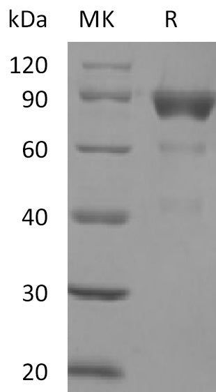 Recombinant Human SIRPB2 (C-Fc)