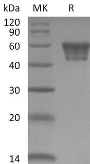 Recombinant Human CD82 (N-Fc)