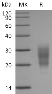 Recombinant Mouse NKG2D (N-6His)