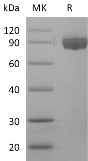 Recombinant Human Afamin (C-6His)