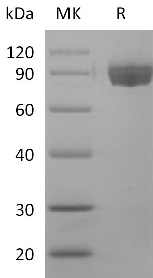 Recombinant Human Afamin (C-6His)
