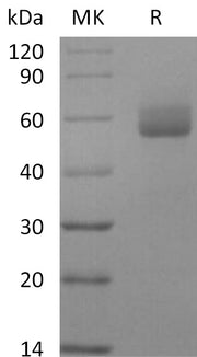 Recombinant Human GPIHBP1 (C-Fc)