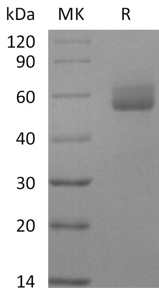 Recombinant Human GPIHBP1 (C-Fc)