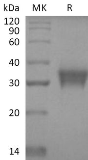 Recombinant Human STC-1 (C-6His)