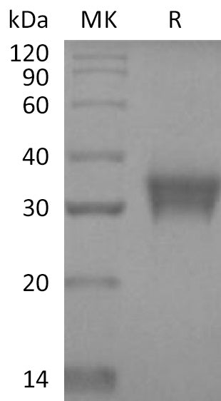 Recombinant Human STC-1 (C-6His)