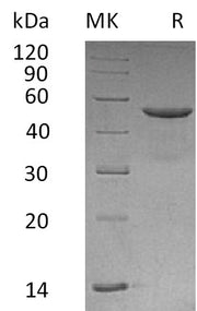 Recombinant Human CD99 (C-Fc)