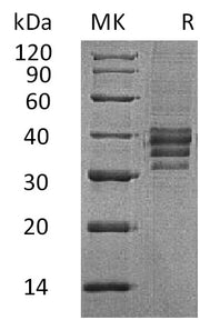 Recombinant Human Follistatin 288 (C-6His)