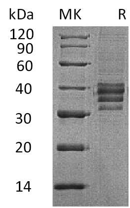 Recombinant Human Follistatin 288 (C-6His)