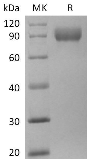 Recombinant Human TRAIL R3 (C-Fc-6His)