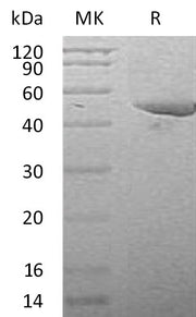 Recombinant Mouse Serpin E1 (C-6His)