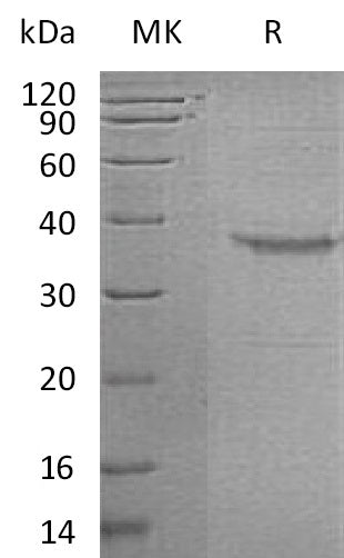 Recombinant Human GHRH (C-Fc)