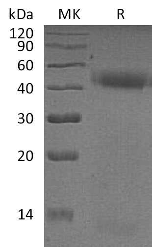 Recombinant Human PSG2 (C-6His)