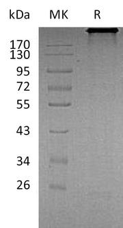 Recombinant Human CDH6 (C-Fc)