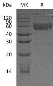 Recombinant Human CD83 (C-Fc)
