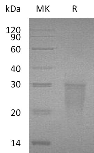 Recombinant Human TMIGD2 (C-6His)