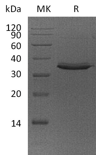 Recombinant Human TWEAK R (C-Fc)