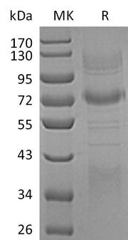 Recombinant Human Clusterin (C-Fc-6His)