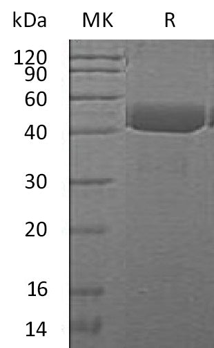 Recombinant Mouse CTSE (C-6His)